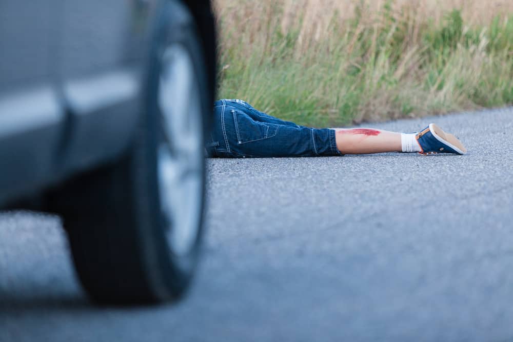 Photo of Wounded Legs of a Boy